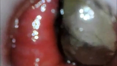 Anal Endoscope Ass Play From Inside